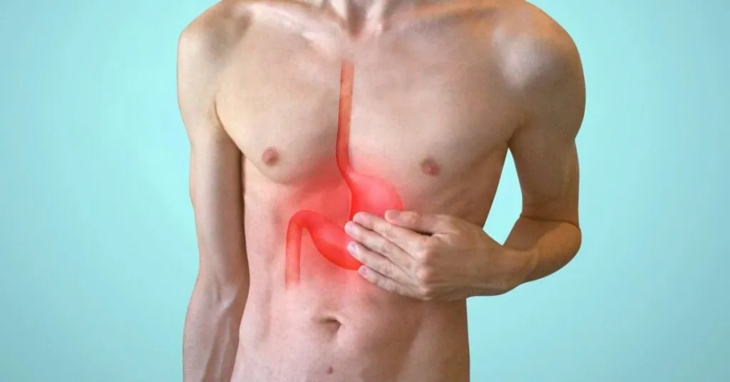 GASTROESOPHAGEAL REFLUX DISEASE | GERD |