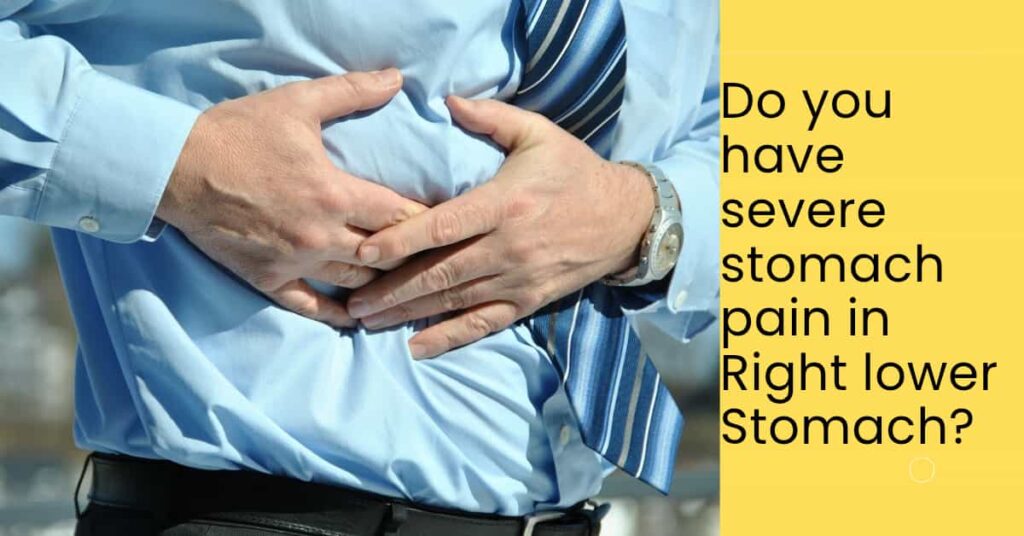 APPENDICITIS: PATHOGENESIS, SIGNS AND MANAGEMENT.