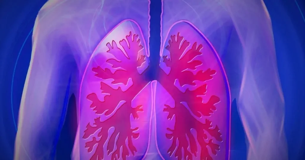 CYSTIC FIBROSIS: CAUSES, PATHOGENESIS, CLINICAL FEATURES, DIAGNOSIS AND TREATMENT